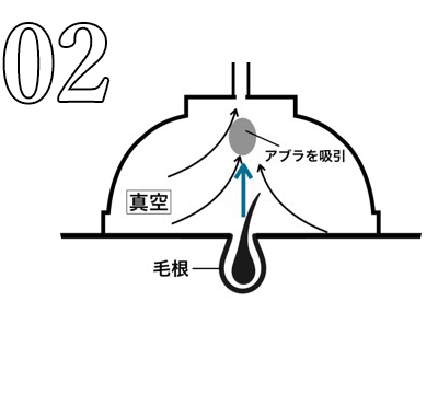 02老化脂を抜き取る